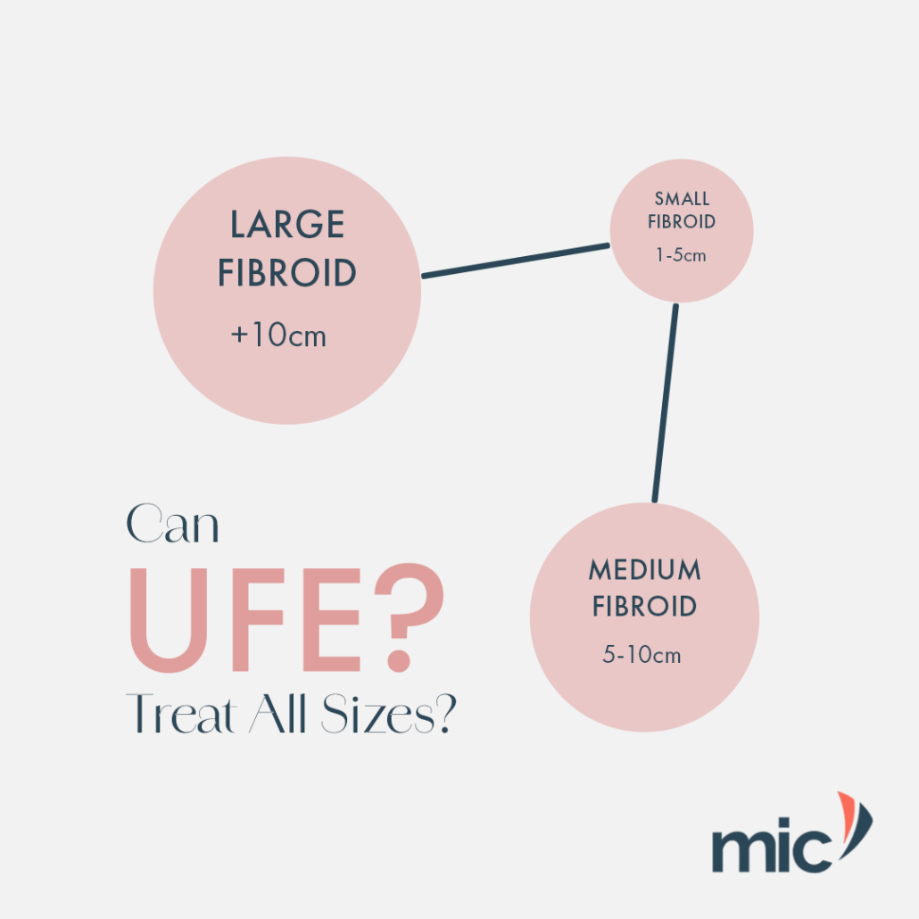 Does UFE treat all fibroid sizes? – MIC Radiology Group