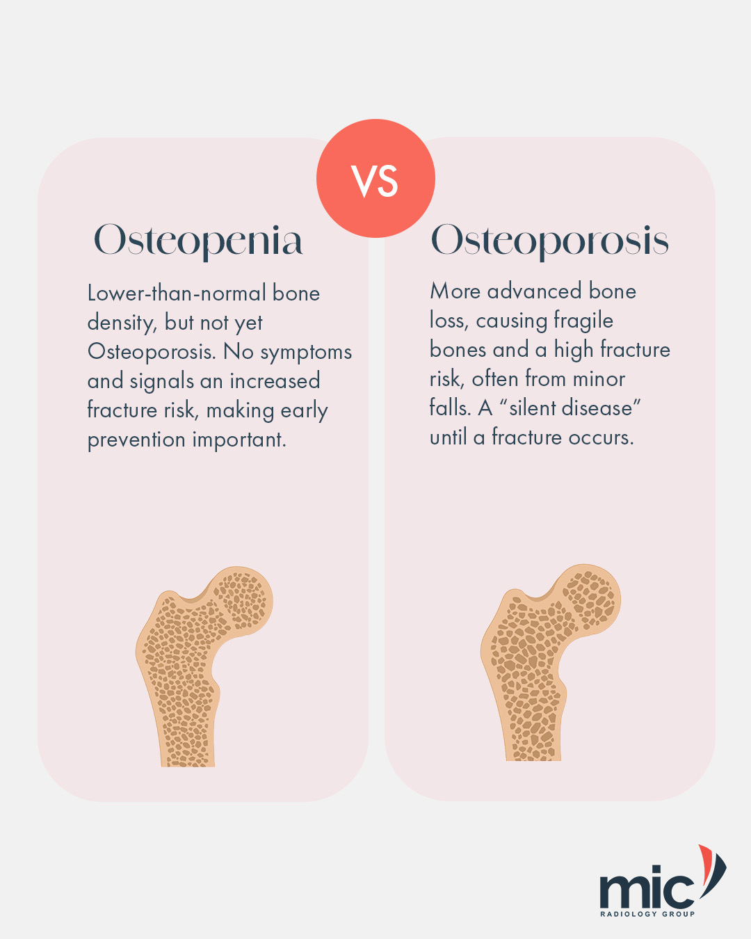 Osteopenia vs Osteoporosis – MIC Radiology Group